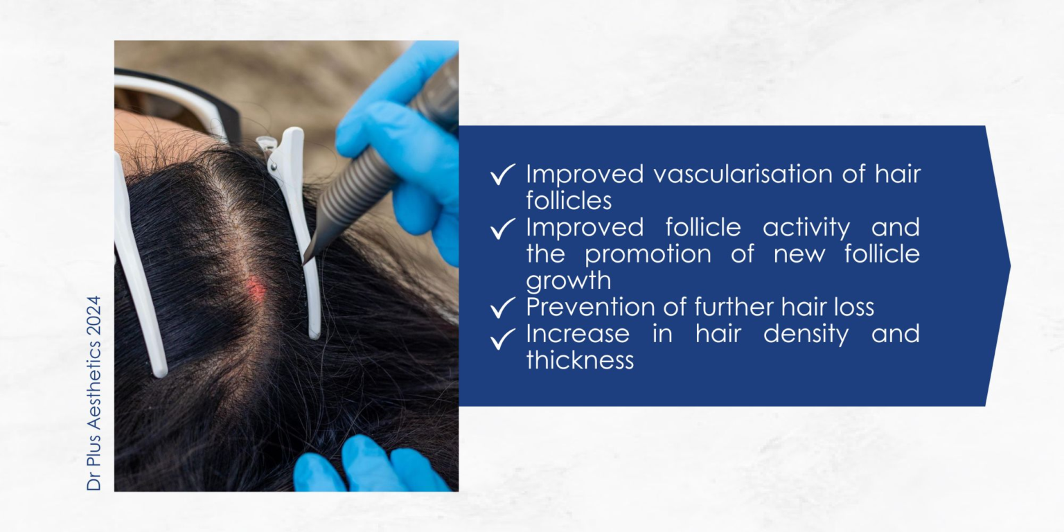 close-up-view-of-patient-receiving-fotona-hair-treatment-1536x768