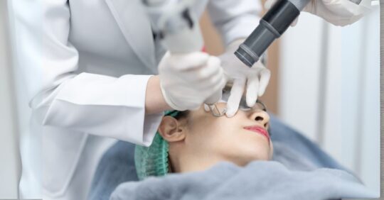 Pico Laser Treatment