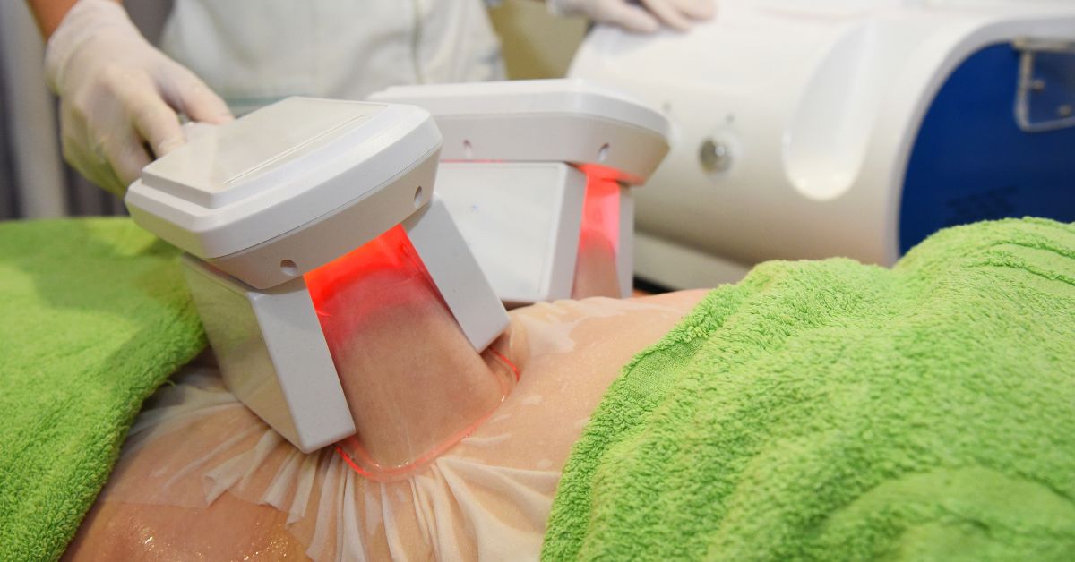 Cryolipolysis Singapore